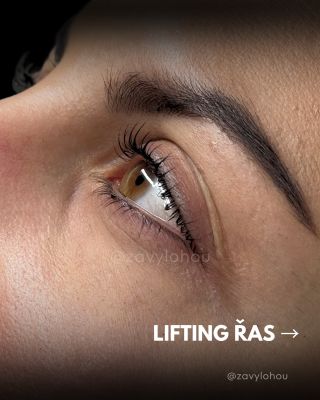 Představte si, že Vaše řasy budou nejen krásně natočené, ale i viditelně hustší, pevnější a zdravější.⁠ ⁠ ✨ Lash lifting...